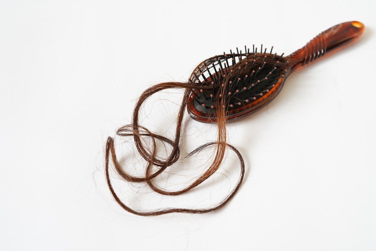 August is National Hair Loss Awareness Month! | By Robin Creations