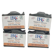 Clear Skin Acne Blasting Face & Body Soap with Banana & Turmeric