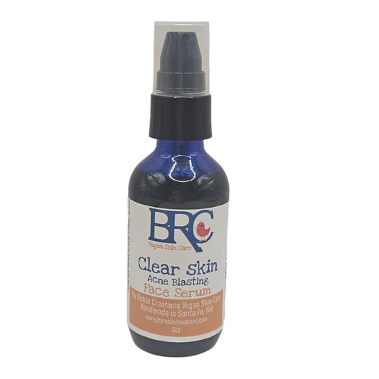  Clear Skin Acne Blasting Face Serum | By Robin Creations
